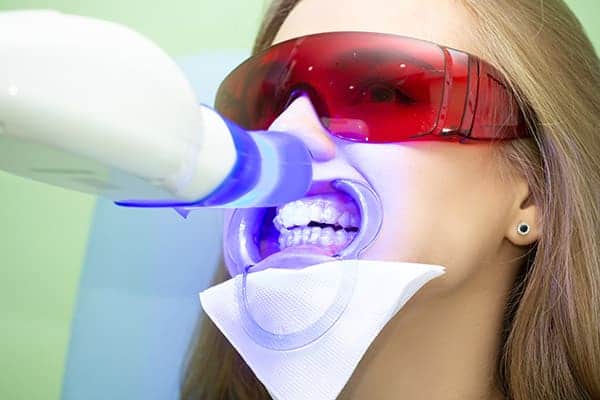 Laser teeth whitening treatments Southampton