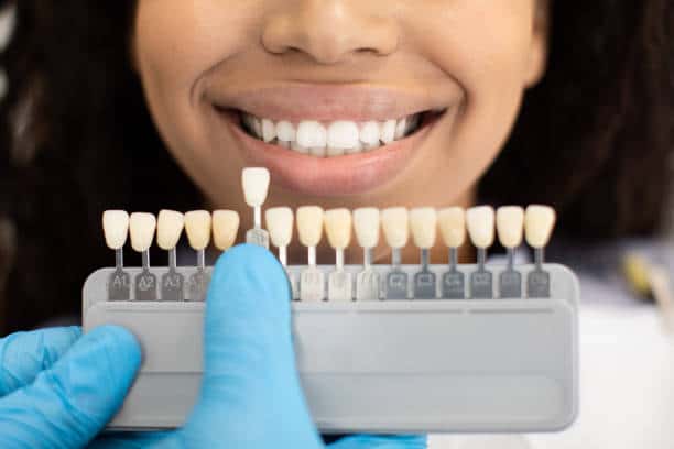 Laser Teeth Whitening: Exploring the Longevity of Your Brighter Smile Southampton