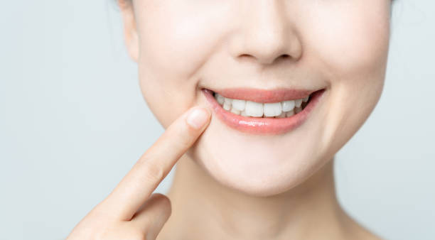 Comparing the Pain Factor: Laser Teeth Whitening vs. Zoom Teeth Whitening Southampton