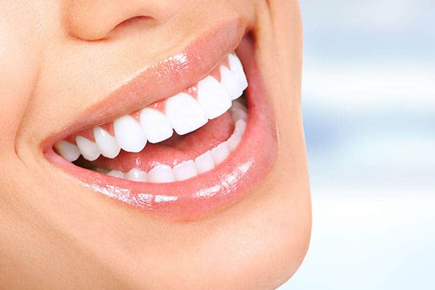 Teeth Whitening Abingdon Southampton